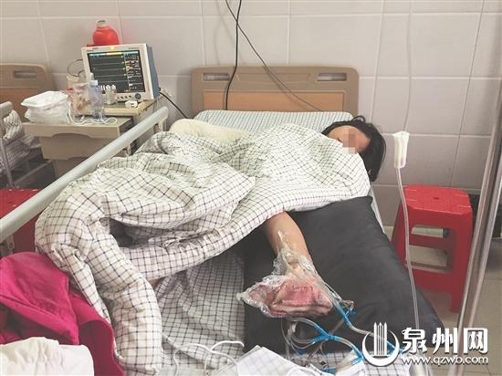 醫生預計小女孩要住院2個月